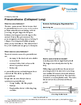 PDF Thumbnail for Pneumothorax