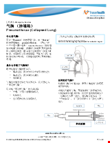PDF Thumbnail for Pneumothorax