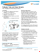 PDF Thumbnail for Fallopian Tube and Ovary Surgery